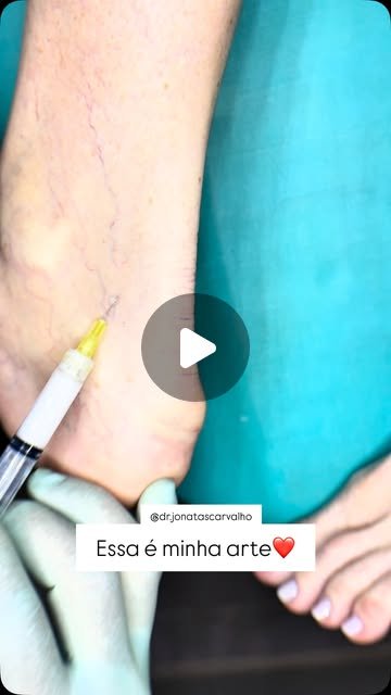 Capa do vídeo: essa é minha arte